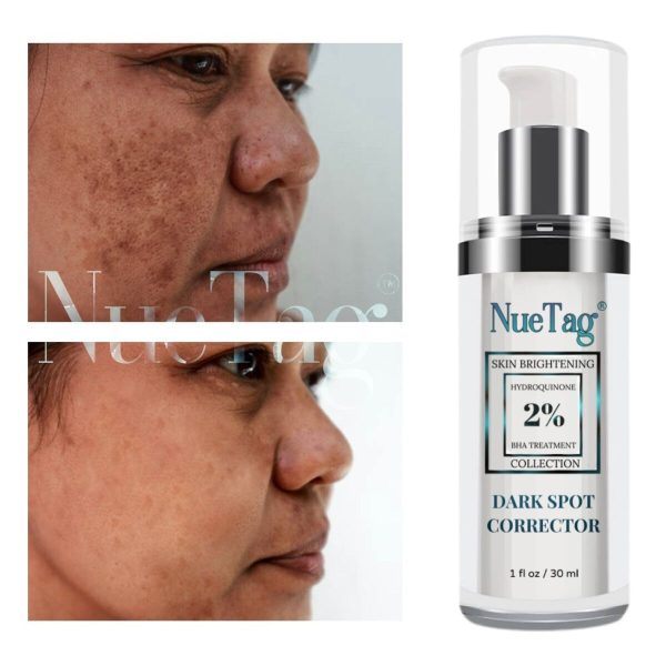 2% Hydroquinone Dark Spot Corrector Remover For Face &