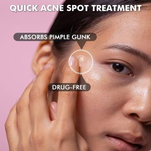 Acne Patch - Hydrocolloid Pimple Patch For Face Zits - Blemish Spot Skin Care