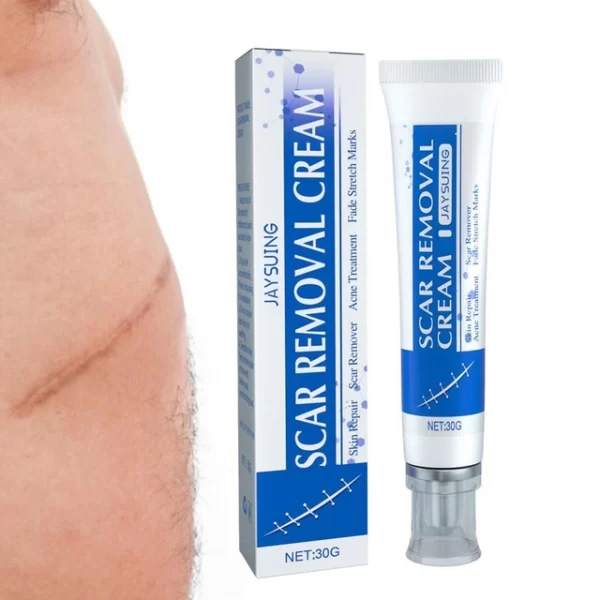 Acne Scar Stretch Marks Remover Cream Hyperplasia