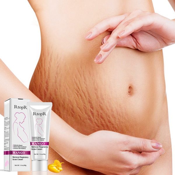 Acne Scar Stretch Marks Remover Cream Postpartum