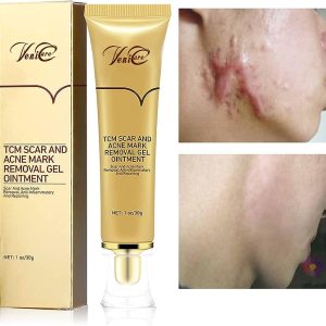 Acne Scars Gel Removal Cream