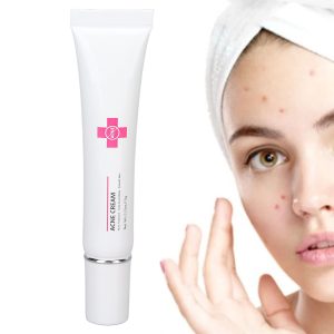 Acne Treatment Face Cream Blackhead Removal