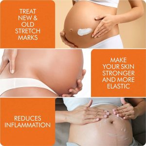 Advanced Stretch Mark Cream by V.SACHAR MD Safe in Pregnancy