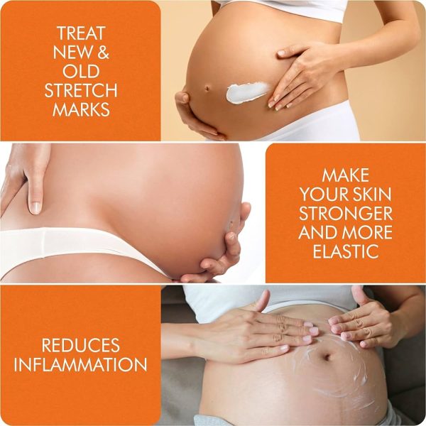 Advanced Stretch Mark Cream by V.SACHAR MD Safe in Pregnancy