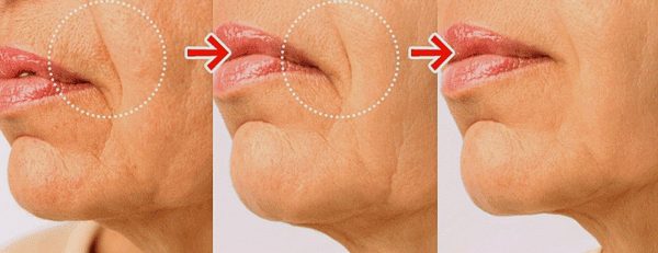 ANTEROGEN (5,000 PPM) instant face lift HUMAN STEM CELL