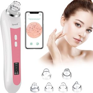 Blackhead Vacuum, AsperX 5.0 Megapixels Visible Blackhead Remover Facial Pore