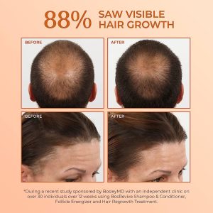 BosleyMD BosRevive Kit for Visible Hair Thinning Starter Size 🌿