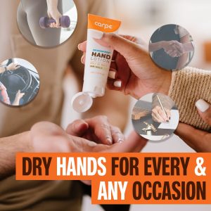 Carpe Antiperspirant Hand Lotion, A dermatologist-recommended