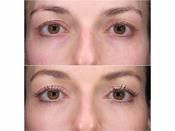 Colorescience Total Eye 3-in-1 Anti-Aging Renewal Therapy