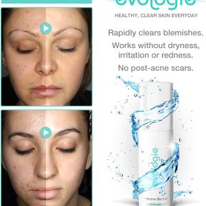 evologie Intensive Blemish Serum | Helps Clear Acne, Dark Spots &