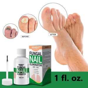 EXTRA STRONG Finger and Toenail Fungus Treatment