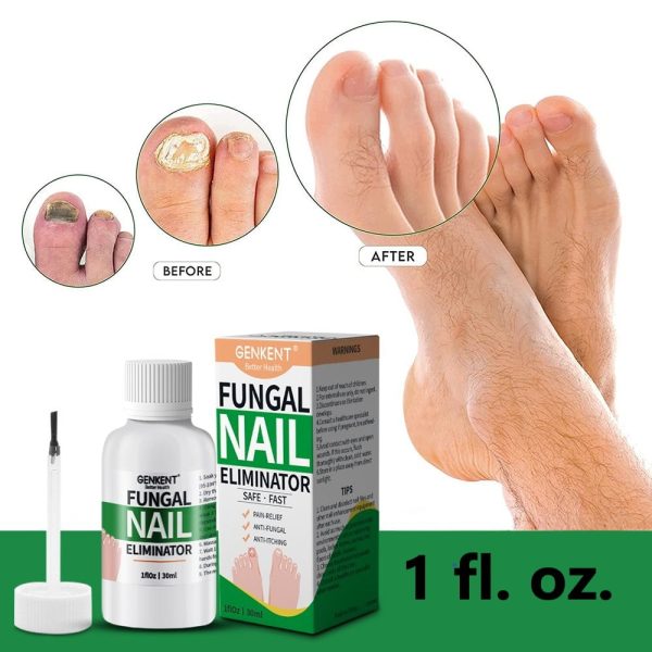 EXTRA STRONG Finger and Toenail Fungus Treatment