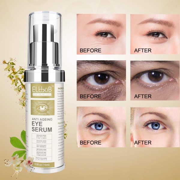 Eye Cream for Dark Circles Eye Bags and Crows Feet