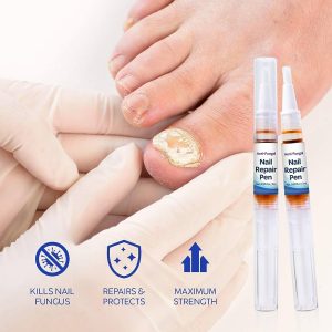 Fungus Stop Nail Repair Pen Toenail Fungus Treatment Fungus Nail Care