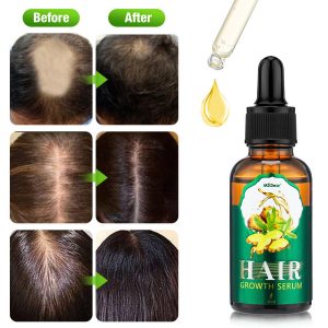Hair Growth Serum 3 Pack,Hair Loss Serum,Hair Treatment Serum