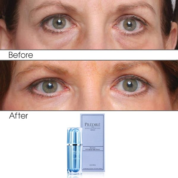 Intensive Rapid Renewal Eye Care Anti Aging Night Serum