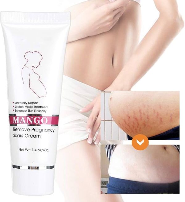 Lancs Stretch Mark Prevention Treatment Cream for Pregnancy