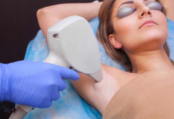 Laser Hair Removal for Women