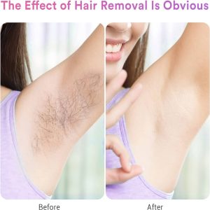 Laser Hair Removal for Women & Men