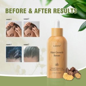 MayBeau Hair Growth Serum, 2 fl.oz Hair Growth Treatment Oil for Men & Women