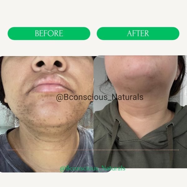 MAZU Facial Hair Removal Epilator For Women - Effectively Remove