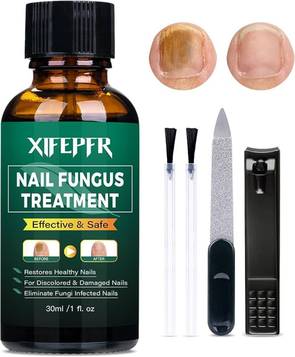 Nail Fungus Repair, Maximum Strength Fungal Toenail Solution