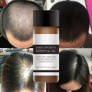 Natural Hair Growth Oil with Caffeine and Biotin - Hair Growth Oil for Stronger