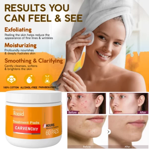 Neutrogena Rapid Clear Acne Face Pads - Clear Skin in Just 8 Hours