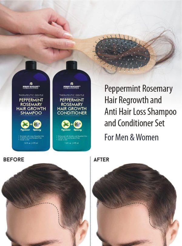 Peppermint Rosemary Hair Regrowth and Anti Hair Loss