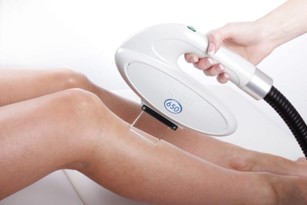 Professional Permanent Hair Removal Machine High Output.