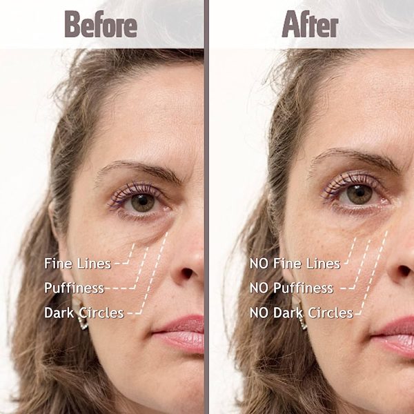 Puffy Eyes Treatment Instant results - Naturally Eliminate Wrinkles, Puffiness