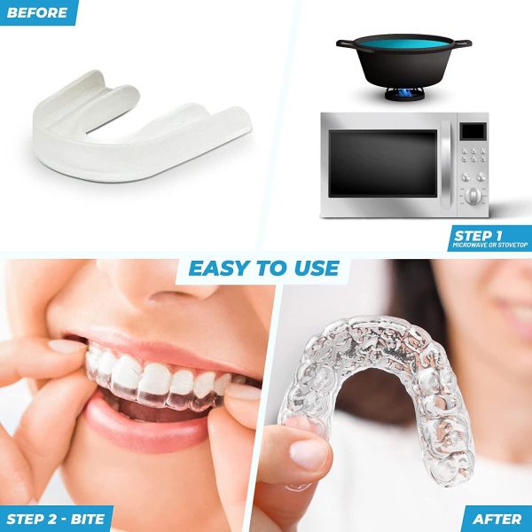 Restwell Dental Nightguard for Teeth Grinding