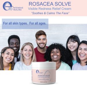 Rosacea Redness Relief Treatment Cream - Soothe Anti Inflammatory Natural Face