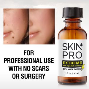 SkinPro Skin Tag Remover And Mole Corrector For Fast Removal Of Skin Moles