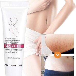 Stretch Mark Cream,Stretch Marks Remover,Stretch Mark Treatment