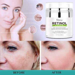 Ulensy Upgraded Retinol Face Cream, Miracle Moisturizing Face Cream