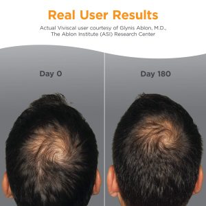 Viviscal Men's Hair Growth Supplements