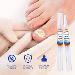 Votala Fungus Treatment Pen, Powerful Antifungal Solution for Toenail
