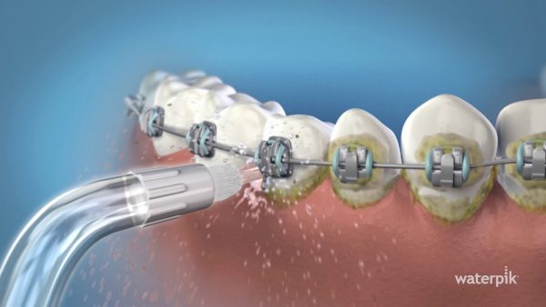 Waterpik Flosser for Teeth, Gums, Braces