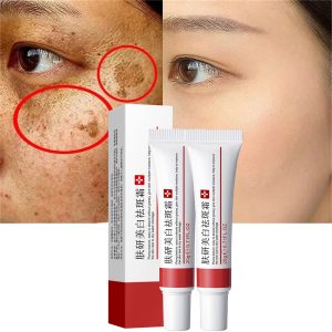 Efficient Whitening Freckle Cream – Remove Melasma, Dark Spots & Acne Pigment | 20ml